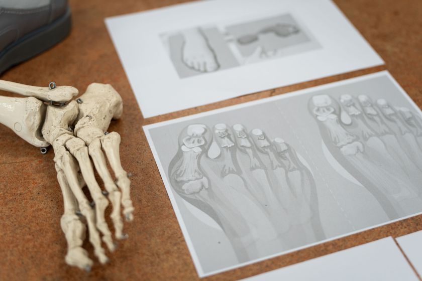 Kaip išsirinkti patogius batus ir apsaugoti pėdų sveikatą – pataria daugiau nei 20 metų su avalyne dirbanti specialistė